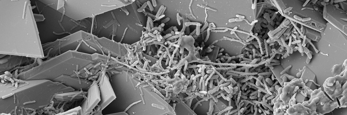 SEM Multispecies biofilms